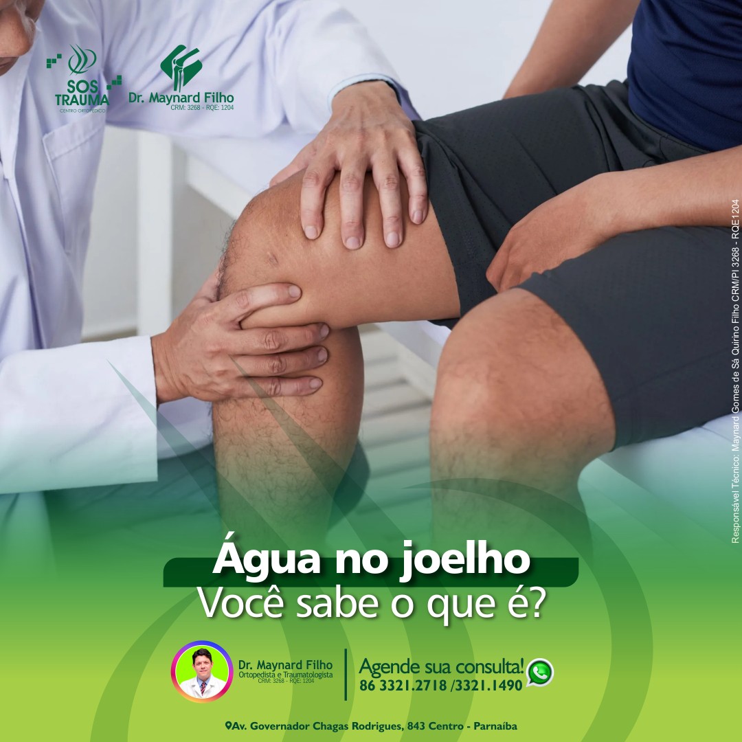 Leia mais sobre o artigo Água no joelho, Você sabe o que é?